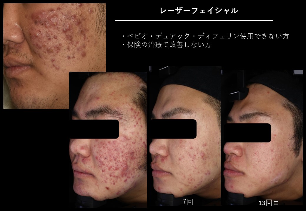 食事とライフスタイルの変化